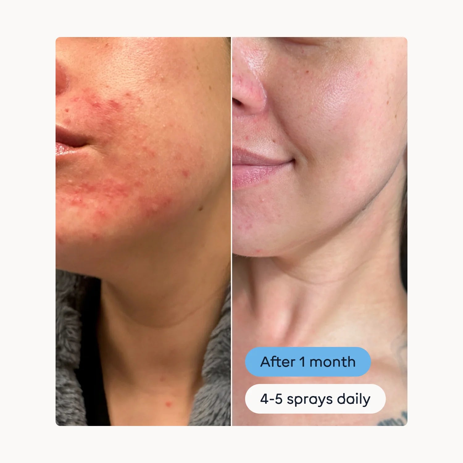 Magic Molecule Hypochlorous Acid Spray (Mini Size)