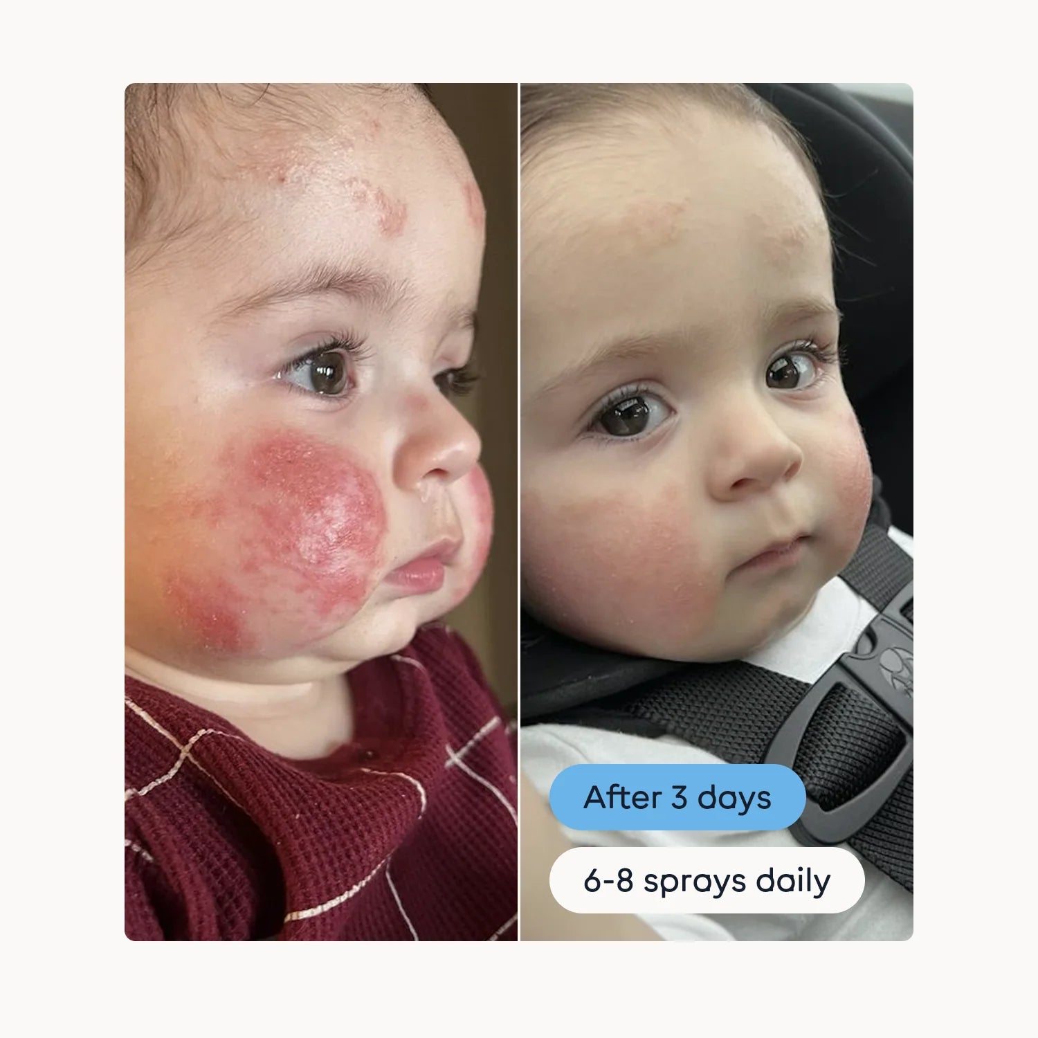 Magic Molecule Hypochlorous Acid Spray (Mini Size)