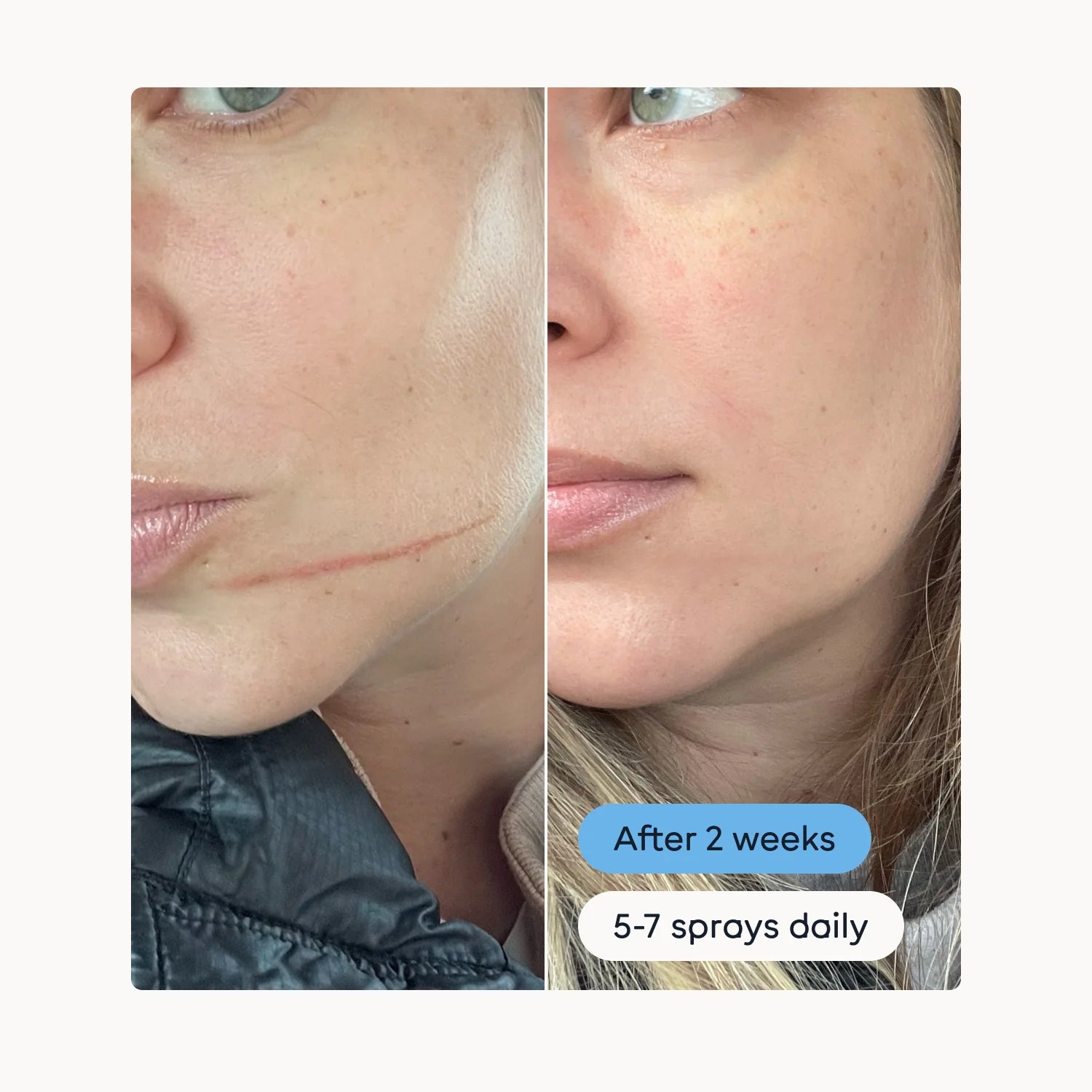 Magic Molecule Hypochlorous Acid Spray (Mini Size)